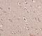 Brain Derived Neurotrophic Factor antibody, M00035-2, Boster Biological Technology, Immunohistochemistry paraffin image 