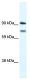 Zinc Finger E-Box Binding Homeobox 2 antibody, TA334225, Origene, Western Blot image 