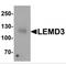LEM Domain Containing 3 antibody, MBS151102, MyBioSource, Western Blot image 