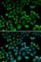 NHL Repeat Containing E3 Ubiquitin Protein Ligase 1 antibody, LS-C335697, Lifespan Biosciences, Immunofluorescence image 