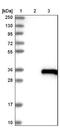 Ubiquitin Domain Containing 1 antibody, NBP1-82311, Novus Biologicals, Western Blot image 