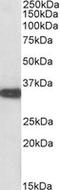 Aspartoacylase antibody, LS-C139740, Lifespan Biosciences, Western Blot image 