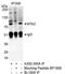 PID antibody, A300-395A, Bethyl Labs, Immunoprecipitation image 