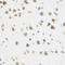 Dihydroorotate Dehydrogenase (Quinone) antibody, 14-896, ProSci, Immunohistochemistry paraffin image 