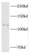 RNA Binding Motif Protein 10 antibody, FNab07158, FineTest, Western Blot image 