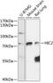 Hypermethylated in cancer 2 protein antibody, 15-479, ProSci, Western Blot image 
