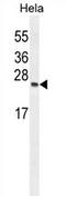 TIMP Metallopeptidase Inhibitor 4 antibody, AP54258PU-N, Origene, Western Blot image 
