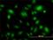 Ubiquitin Specific Peptidase 34 antibody, H00009736-M01, Novus Biologicals, Immunofluorescence image 