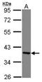 Eukaryotic Translation Elongation Factor 1 Delta antibody, GTX111151, GeneTex, Western Blot image 