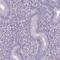 SLC30A3 antibody, HPA060505, Atlas Antibodies, Immunohistochemistry paraffin image 