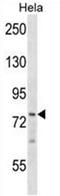 ZFP36 Ring Finger Protein Like 1 antibody, AP50389PU-N, Origene, Western Blot image 
