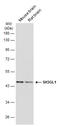 SH3 Domain Containing GRB2 Like 1, Endophilin A2 antibody, GTX634708, GeneTex, Western Blot image 