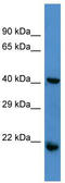 Regulator Of G Protein Signaling 7 antibody, TA329134, Origene, Western Blot image 