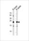 Ras-related protein Rab-11B antibody, LS-C162356, Lifespan Biosciences, Western Blot image 