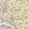 Keratin 8 antibody, A1024, ABclonal Technology, Immunohistochemistry paraffin image 
