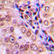MTK1 antibody, GTX55270, GeneTex, Immunohistochemistry paraffin image 