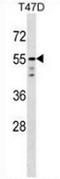 Akt antibody, AP13559PU-N, Origene, Western Blot image 