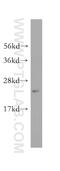Programmed Cell Death 10 antibody, 10294-2-AP, Proteintech Group, Western Blot image 
