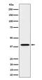DDB1 And CUL4 Associated Factor 7 antibody, M08577, Boster Biological Technology, Western Blot image 