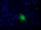 Carnosine N-Methyltransferase 1 antibody, M14721-1, Boster Biological Technology, Immunofluorescence image 