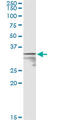 Mercaptopyruvate Sulfurtransferase antibody, LS-C197700, Lifespan Biosciences, Immunoprecipitation image 