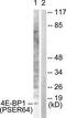 Eukaryotic Translation Initiation Factor 4E Binding Protein 1 antibody, TA326049, Origene, Western Blot image 