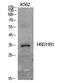 Hydroxysteroid 11-Beta Dehydrogenase 1 antibody, STJ97255, St John
