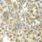 Tumor Necrosis Factor antibody, A0277, ABclonal Technology, Immunohistochemistry paraffin image 