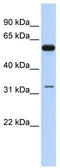 DEAD-Box Helicase 28 antibody, TA341607, Origene, Western Blot image 