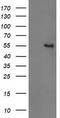 Glucosylceramidase Beta 3 (Gene/Pseudogene) antibody, TA502602, Origene, Western Blot image 