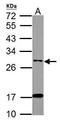 Integral Membrane Protein 2B antibody, PA5-31441, Invitrogen Antibodies, Western Blot image 