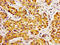 Sterol 26-hydroxylase, mitochondrial antibody, LS-C671177, Lifespan Biosciences, Immunohistochemistry paraffin image 