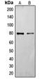 Frizzled Class Receptor 6 antibody, orb214777, Biorbyt, Western Blot image 