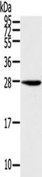 Potassium Calcium-Activated Channel Subfamily M Regulatory Beta Subunit 3 antibody, TA351321, Origene, Western Blot image 