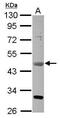 Vascular endothelial growth factor D antibody, GTX113695, GeneTex, Western Blot image 