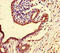 PIF1 5'-To-3' DNA Helicase antibody, LS-C679027, Lifespan Biosciences, Immunohistochemistry paraffin image 