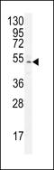 Zinc Finger Protein 829 antibody, LS-C160954, Lifespan Biosciences, Western Blot image 