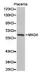 Monoamine Oxidase A antibody, LS-C192827, Lifespan Biosciences, Western Blot image 