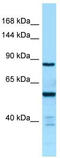 CTD Phosphatase Subunit 1 antibody, TA337945, Origene, Western Blot image 