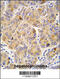 4-trimethylaminobutyraldehyde dehydrogenase antibody, 63-242, ProSci, Immunohistochemistry paraffin image 