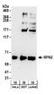 Ribophorin II antibody, A304-265A, Bethyl Labs, Western Blot image 
