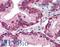 EGFR antibody, LS-B2199, Lifespan Biosciences, Immunohistochemistry frozen image 