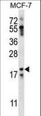 Neuritin 1 Like antibody, LS-C163015, Lifespan Biosciences, Western Blot image 