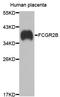 Low affinity immunoglobulin gamma Fc region receptor II-b antibody, A7554, ABclonal Technology, Western Blot image 