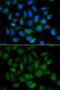 Alpha Fetoprotein antibody, GTX30030, GeneTex, Immunofluorescence image 