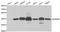 TAR DNA Binding Protein antibody, A1183, ABclonal Technology, Western Blot image 