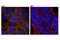 Cadherin-3 antibody, 14029S, Cell Signaling Technology, Immunocytochemistry image 