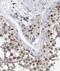 Arginine And Serine Rich Coiled-Coil 1 antibody, FNab07513, FineTest, Immunohistochemistry paraffin image 