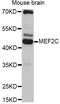 Myocyte-specific enhancer factor 2C antibody, A12385, ABclonal Technology, Western Blot image 