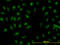 Ribosomal RNA Processing 9, U3 Small Nucleolar RNA Binding Protein antibody, LS-C133106, Lifespan Biosciences, Immunofluorescence image 